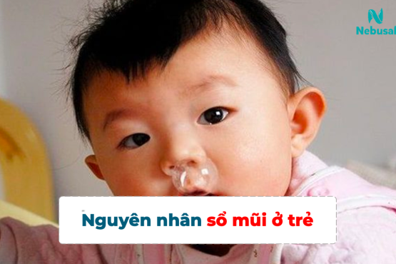 Top 5 nguyên nhân sổ mũi ở trẻ em và cách xử trí