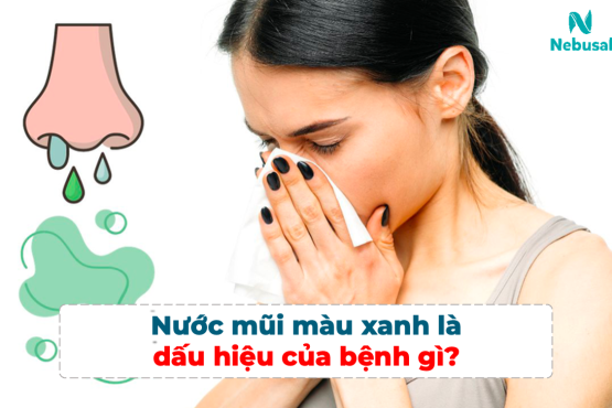 Nước mũi màu xanh là dấu hiệu của bệnh gì? 