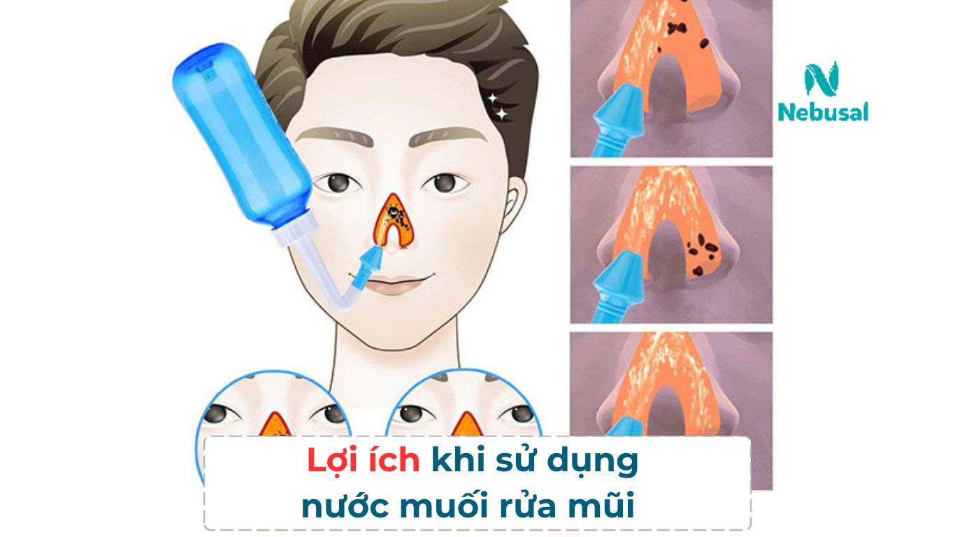 Nước muối rửa mũi