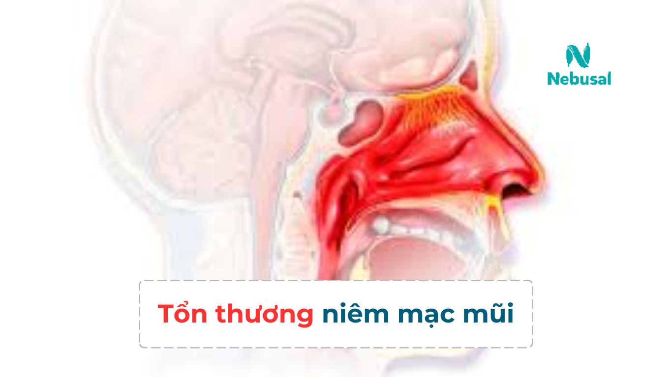 Tổn thương niên mạc mũi