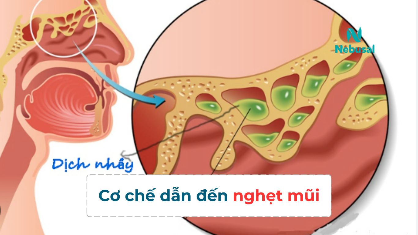 nghet-mui