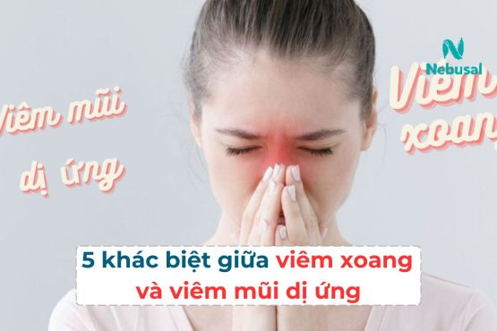 5 khác biệt cơ bản giữa viêm xoang và viêm mũi dị ứng