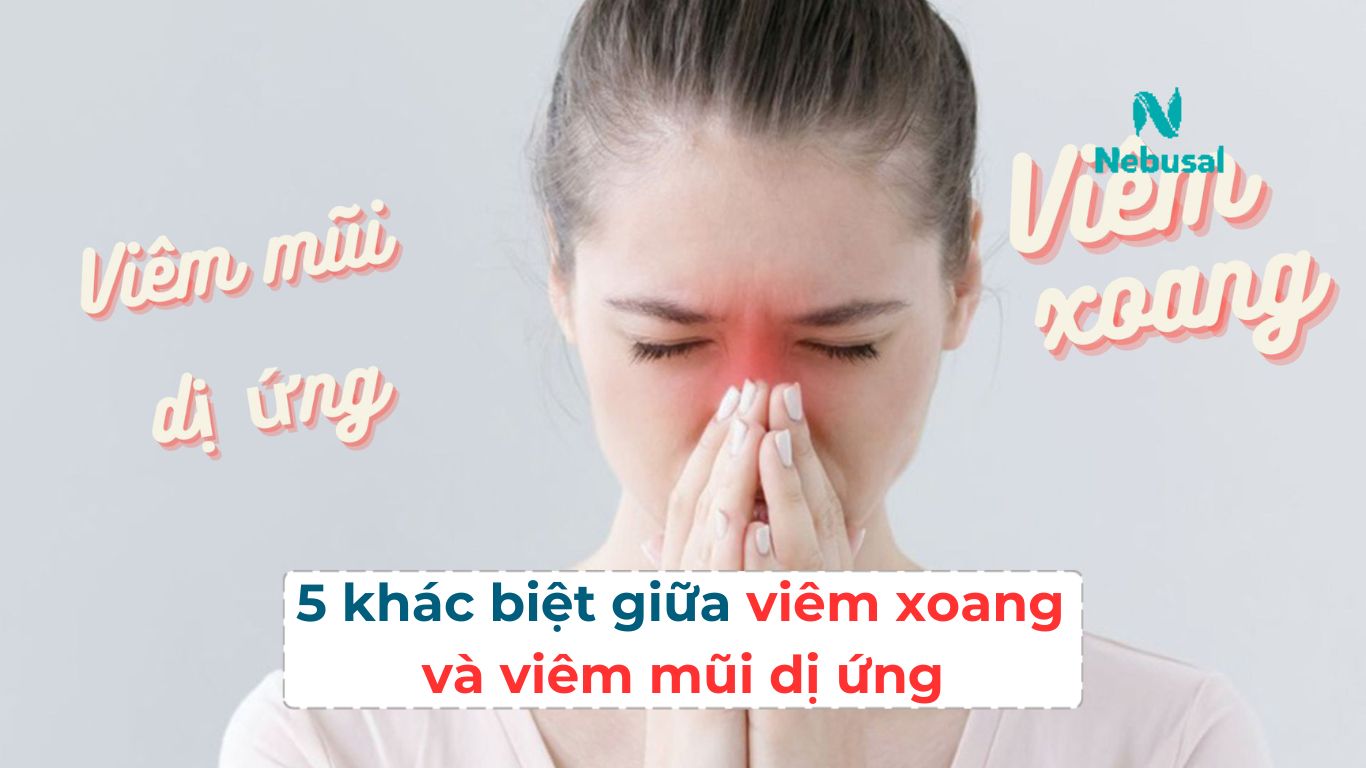 viem-xoang-viem-mui-di-ung