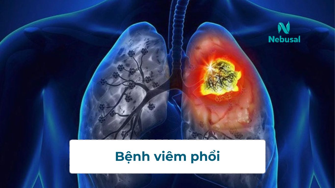 viem-phoi